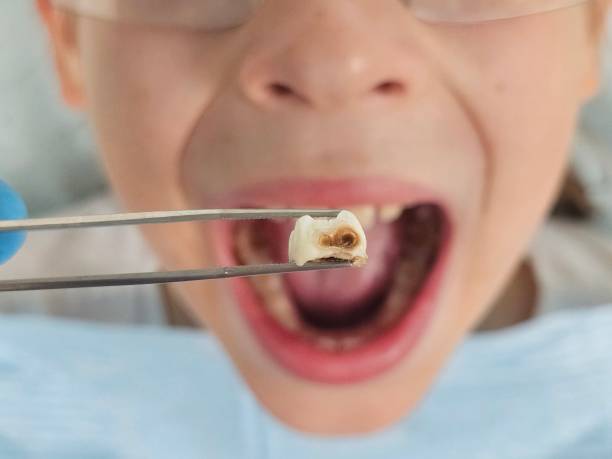 Best Holiday Emergency Dentist in Sperry, OK