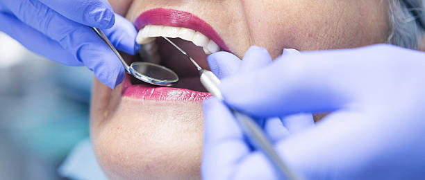 Best Emergency Dental Extractions in Sperry, OK