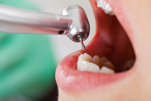 Best Emergency Dentist for Special Needs Patients in Sperry, OK